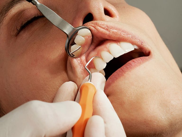 dentist cleaning teeth